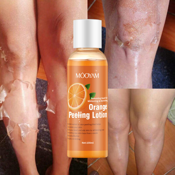 Orange Peel Lotion Peeling Oil Body Lotion Gentle Exfoliation - Image 5